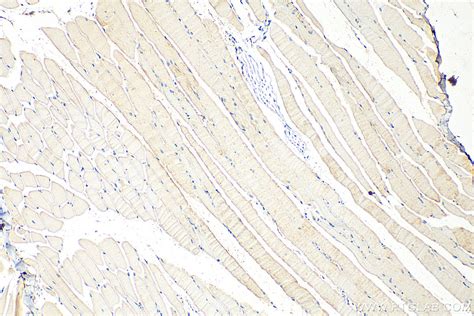 CLEC2L antibody (31928-1-AP) | Proteintech