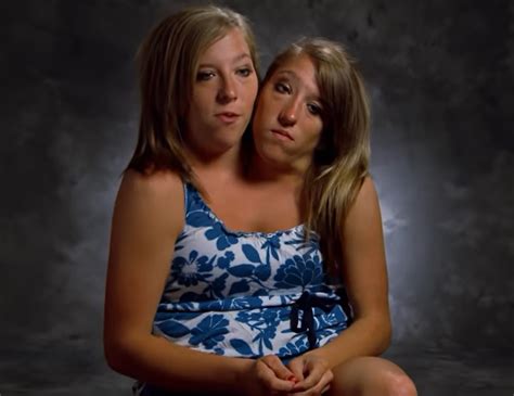 Siamese Twins Hensel