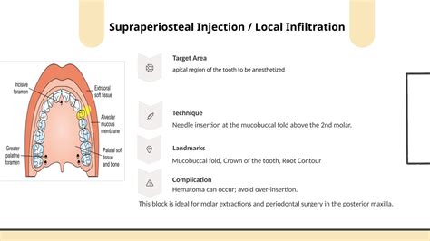 Maxillary Local Anesthesia 的图像结果