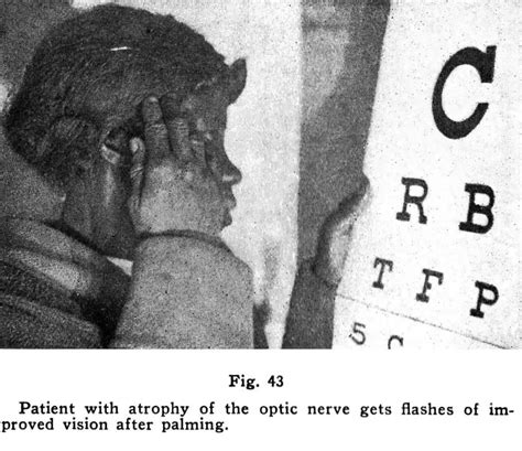 Image result for Bates Method Explained
