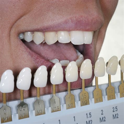 Zoom!® In-office vs. GLO Take-home Teeth Whitening - Kansas City, MO