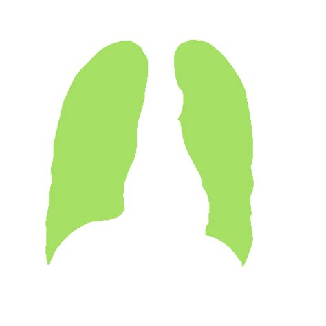 Chest Xray Masks and Labels - Dataset Ninja