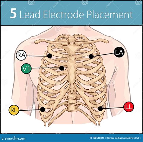 Five Lead ECG Placement
