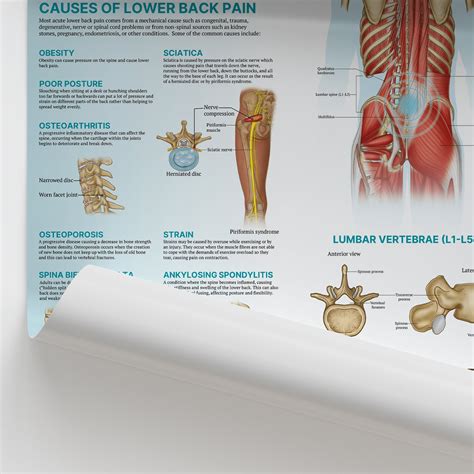 Anatomy Of Lower Back Muscular Low Back Pain | Sydney Physiotherapist - back pain chart