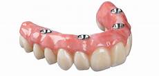 protesi dentali mobili protesi dentali in albania prezzi dental care albania protesi dentali mobili protesi dentali in albania prezzi dental care albania