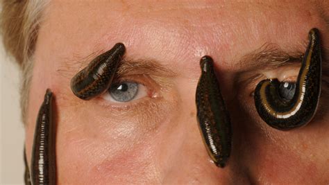 Largest Leech