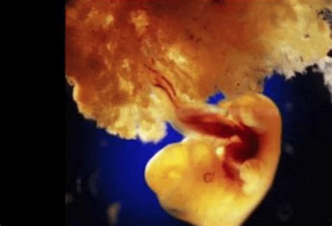 怀孕多久可以看到胎心胎芽？ - 知乎