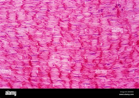 Spindle Shape 的图像结果