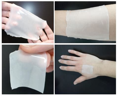 Polymeric Bioadhesive Patch Based on Ketoprofen-Hydrotalcite Hybrid for ...