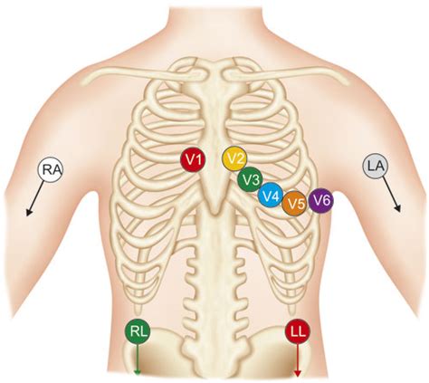 Image result for PVC Localization