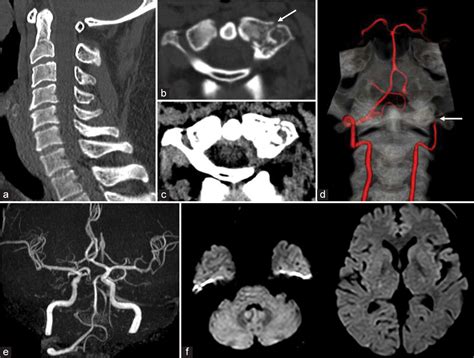 Surgical Neurology International