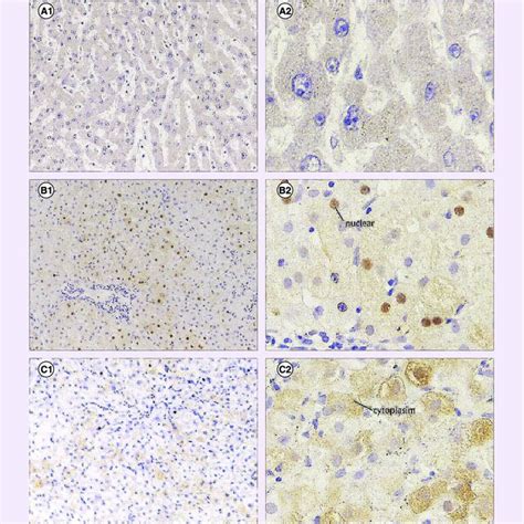 Image result for Pathology Classification System