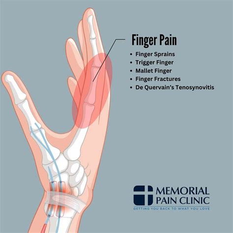 Hand Pain Diagram | Memorial Pain Clinic | Tulsa, OK