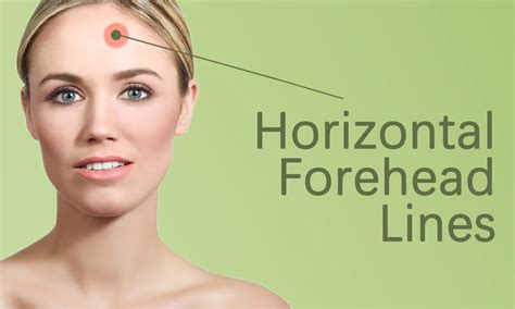 Horizontal Forehead Lines Treatment in Surat - Elegance Clinic