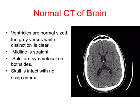 Normal CT BRAIN | PPTX