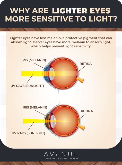 Are Lighter Eyes More Sensitive to the Sun?