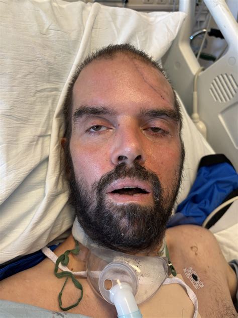 UCLA Medical Center Seeks Public’s Help Identifying Unconscious ‘John ...
