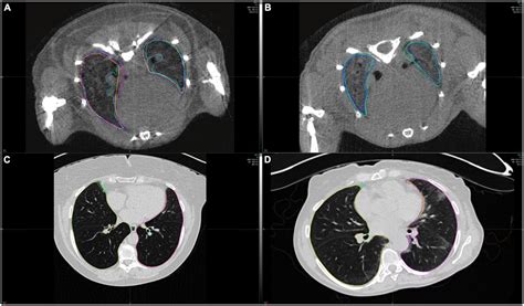 Frontiers | Transferability of radiomic signatures from experimental to human interstitial lung ...