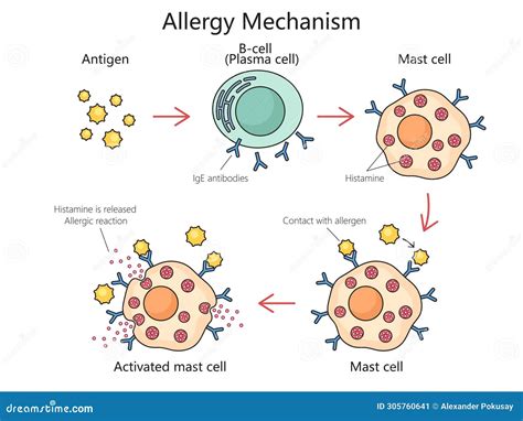 Mechanism Allergy Action Diagram Medical Science Stock Illustration - Illustration of diagram ...