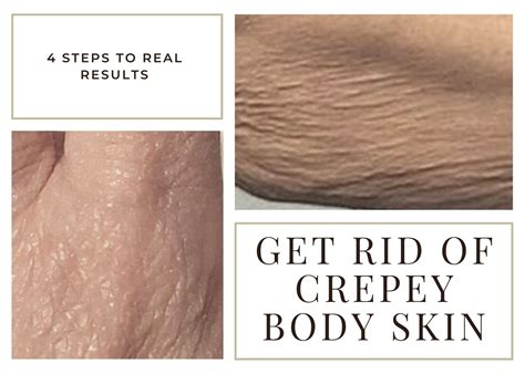 How to (REALLY) GET RID OF CREPEY BODY SKIN (4 KEY STEPS TO TAKE) — Ageless Beauty Pro - ANTI ...