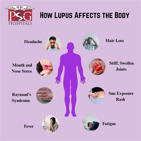 From Shadows to Strength: Lupus Awareness Matters! World Lupus Day ...