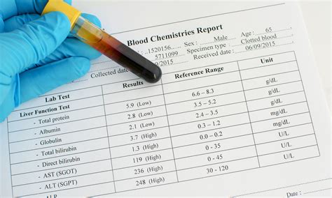 What is Alpha-2-Globulin (Serum)?