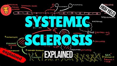 Image result for Diffuse Systemic Scleroderma