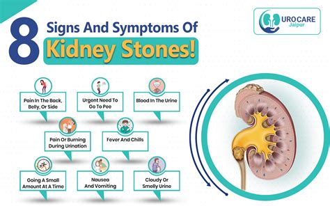 Signs Of A Kidney Stone
