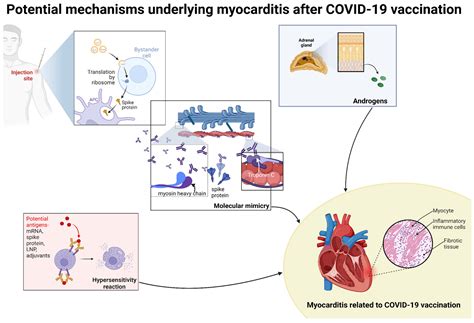 Myocarditis Associated with COVID-19 Vaccination