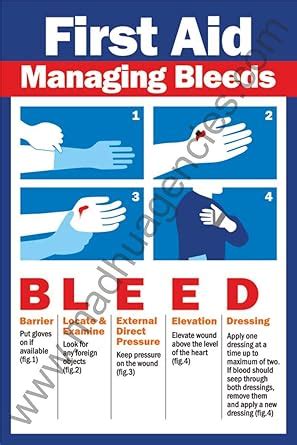 first aid managing bleeds poster in self adhesive vinyl Sticker (24" X ...