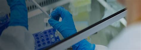 Best Laboratory Medicine Hospital in India | Aster Hospitals