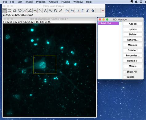 Fiji ImageJ Download 的图像结果