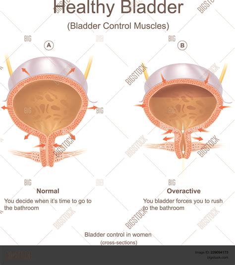 Human Bladder