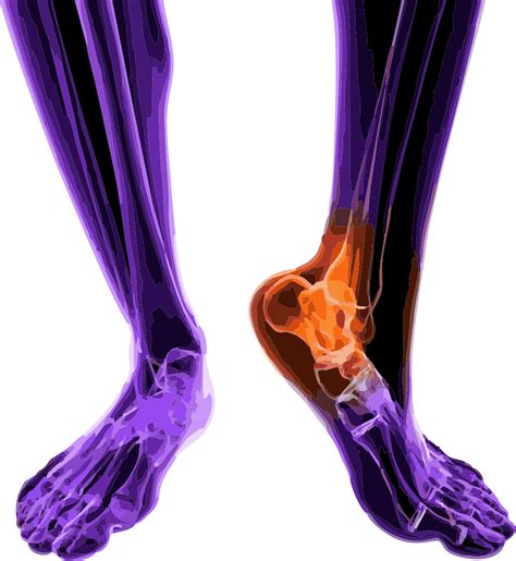 sports injuries 的图像结果