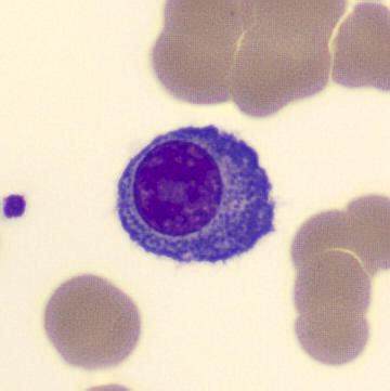 Image result for Monocyte Electron Microscope