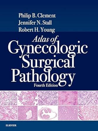 Atlas of Gynecologic Surgical Pathology E-Book eBook : Clement MD ...