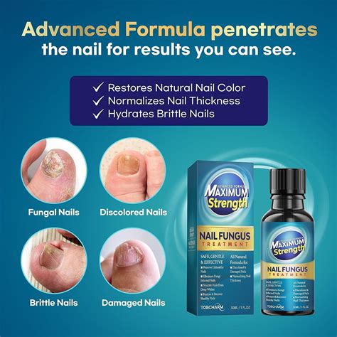 Extra Strength Toenail Fungus Treatment for Thick, Broken, Discolored ...