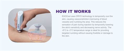 Buy Exocool Painless Injection Non Invasive Numbing Device - Instant ...