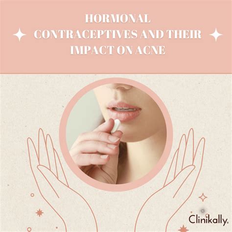 Period Acne: Symptoms, Causes and Treatment | Clinikally