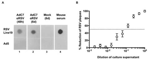 Vaccines | Special Issue : Vaccines for Respiratory Syncytial Virus