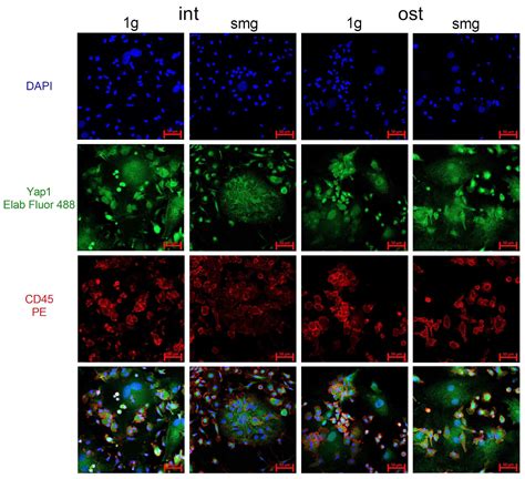 Hippo Signaling Pathway Involvement in Osteopotential Regulation of ...