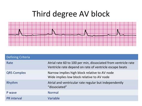 Image result for ACLS Code Blue Algorithm