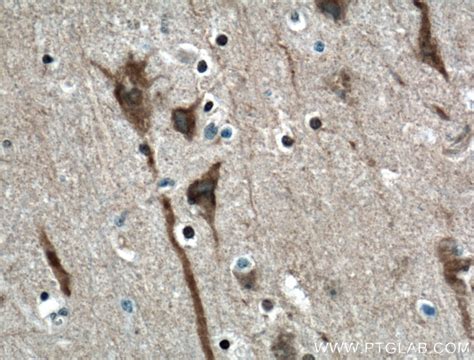 ITPR1-specific antibody (19962-1-AP) | Proteintech