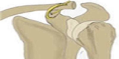 Joint and Bones