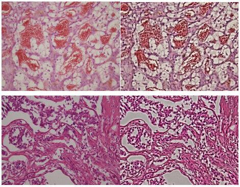 Clahe Algorithm Equation 的图像结果