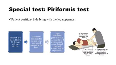 Piriformis Syndrome.pdf