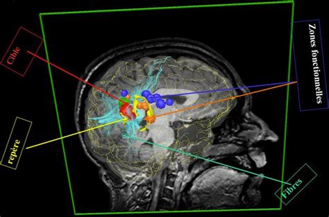 Image result for fMRI Python