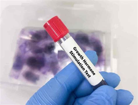 Learn All About a Growth Hormone Stimulation Test