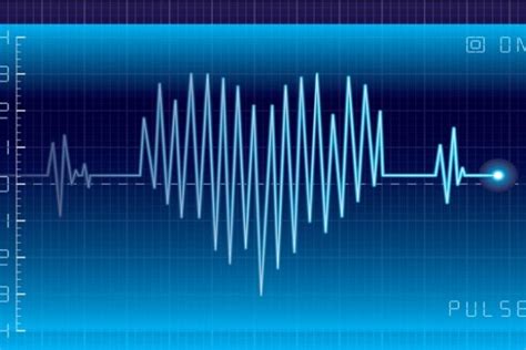 Arrhythmia Definition 的图像结果