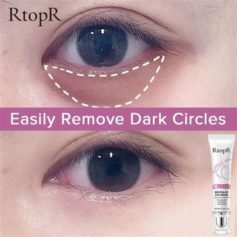 Eye Care Cream For Removal Of Dark Circles, Puffiness, And Bags ...